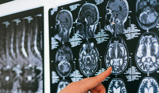 Präzise Diagnose dank moderner Radiologie